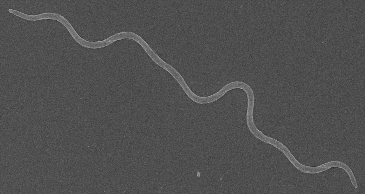 A single cell of the Lyme disease pathogen, Borelia burgdorferi, appears spaghetti-like